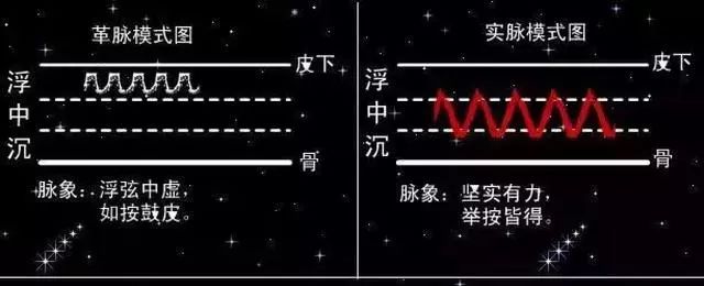 脉象模式对比图一