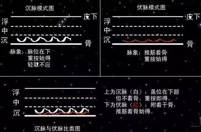 脉象模式对比图四